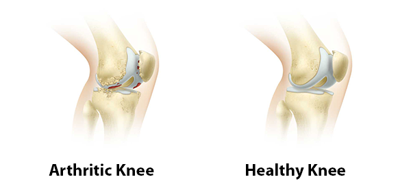 Knee  ditki medical and biological sciences