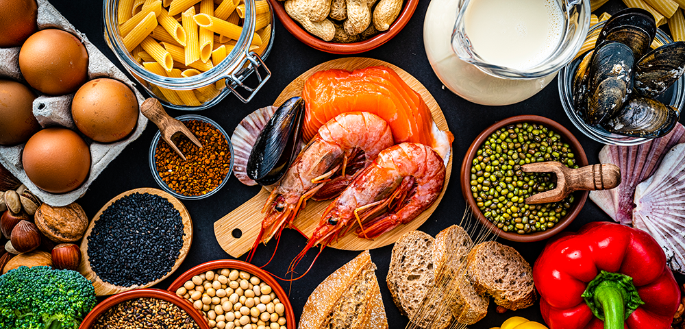 What Are Food Allergies?